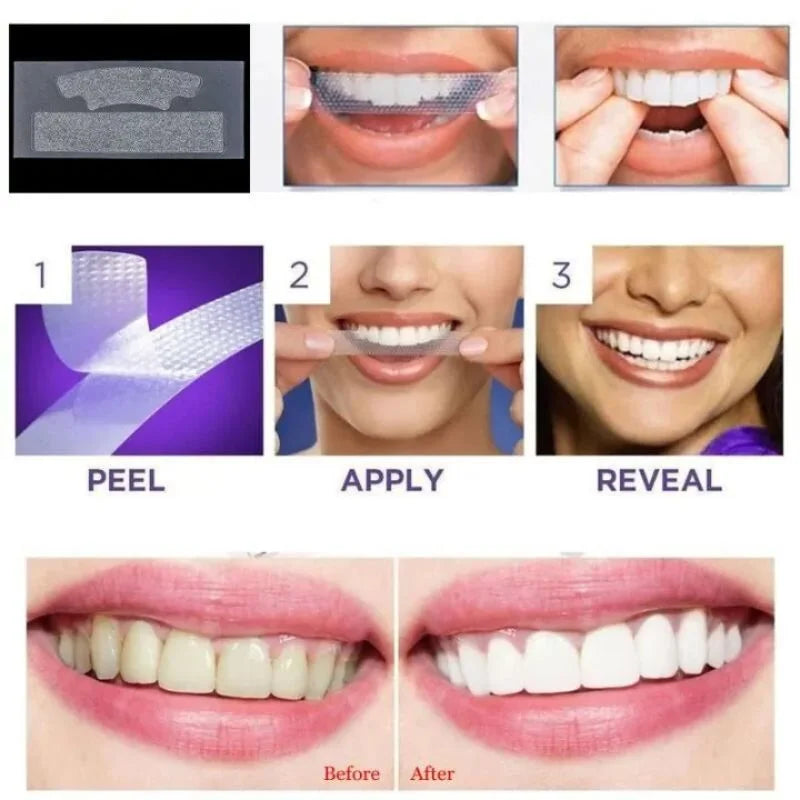 Gegemoon 3D Teeth Whitening Strips