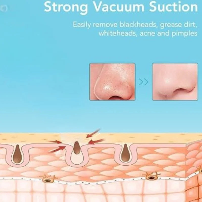 Rechargeable Blackhead Remover Vacuum Cleaner | Model FPLS-001